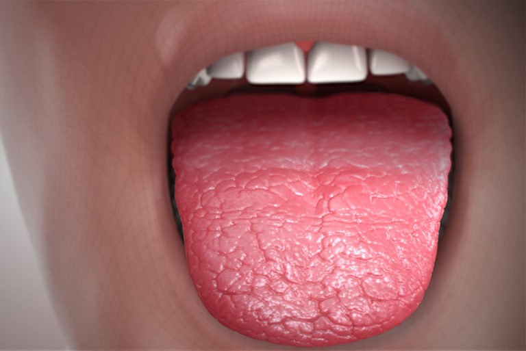 Dry Mouth - Dr. Salim Nasser | Dentists in Markham - Dental Fillings ...