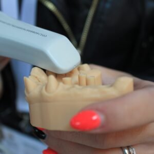 What You Need to Know After a Dental Filling Treatment