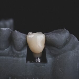 3 Reasons to Get Dental Implants and Address Your Oral Needs
