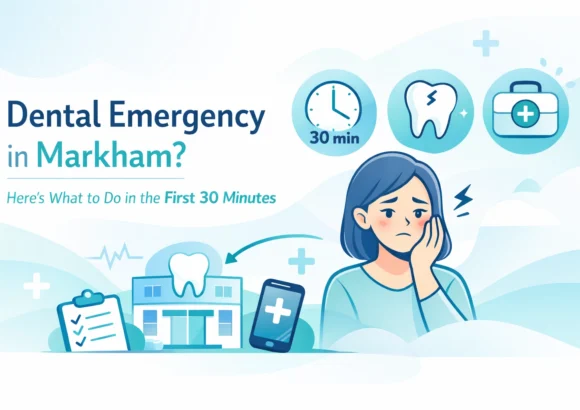Dental Emergency in Markham? Here’s What to Do in the First 30 Minutes